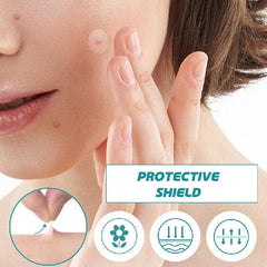 Hydrocolloid Acne Patches for Face - 48pcs Pimple Patch & Acne Stickers