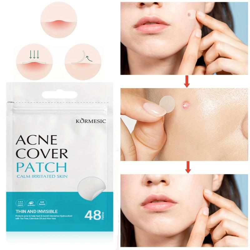 Hydrocolloid Acne Patches for Face - 48pcs Pimple Patch & Acne Stickers