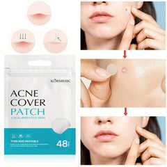 Hydrocolloid Acne Patches for Face - 48pcs Pimple Patch & Acne Stickers