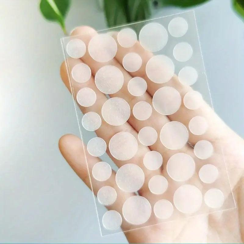 Hydrocolloid Acne Patches for Face - 48pcs Pimple Patch & Acne Stickers