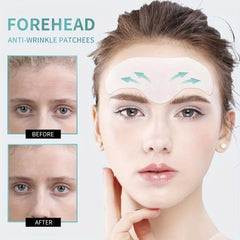 Retinol Forehead Wrinkle Patches