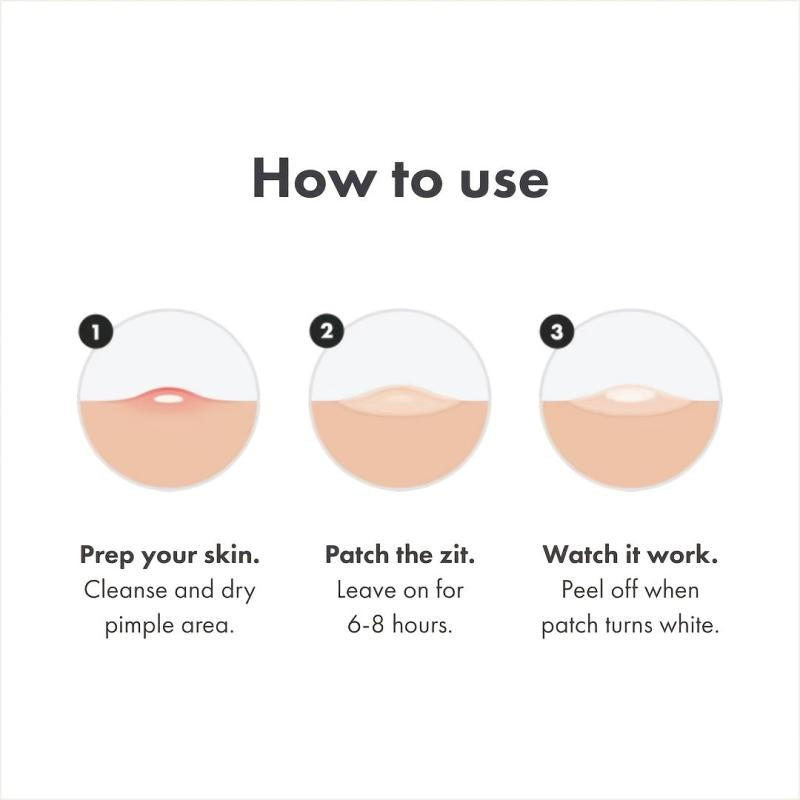 Skin Tag Cleanser Patches - Acne Pimple Patch - Zits Cover