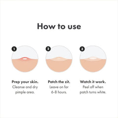 Skin Tag Cleanser Patches - Acne Pimple Patch - Zits Cover