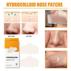 Blackhead Removal Nose Patch Clean Acne Pimples Unclog Pores