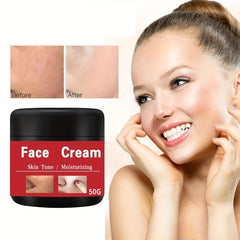 Age Spot Reducing Freckle Cream