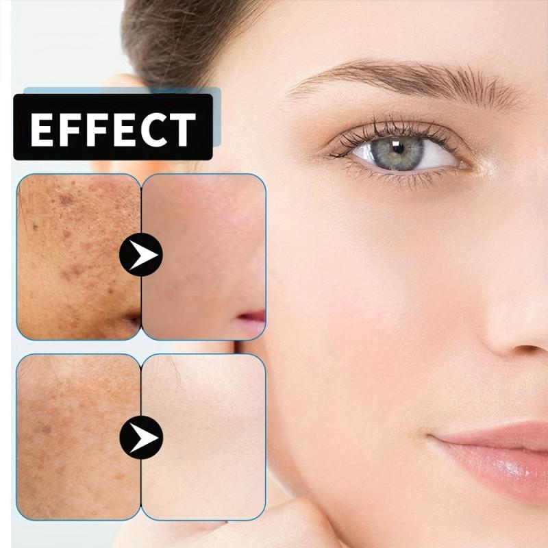 Age Spot Reducing Freckle Cream