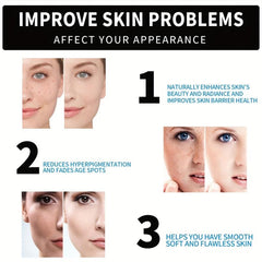 Age Spot Reducing Freckle Cream