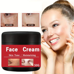 Age Spot Reducing Freckle Cream