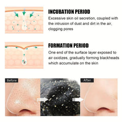 Bamboo Charcoal Pig Nose Mask - Acne Removal Set