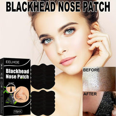 Bamboo Charcoal Pig Nose Mask - Acne Removal Set