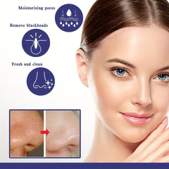 Gentle Deep Cleansing Pore Strips - 6PCS