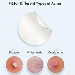 Acne Cover Patch Hydrocolloid Pimple Patch Zits Blemishes Spot Stickers