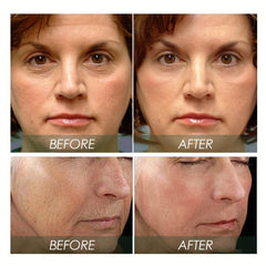 Moisturizing Cream with Vitamin C & Hyaluronic Acid