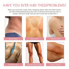 50g Body Rejuvenation Cream Repair Joints Acanthoderma Moisturizing Crea