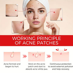 24 Pcs Acne Pimple Patch For Blemishes And Zits Cover Spot Stickers