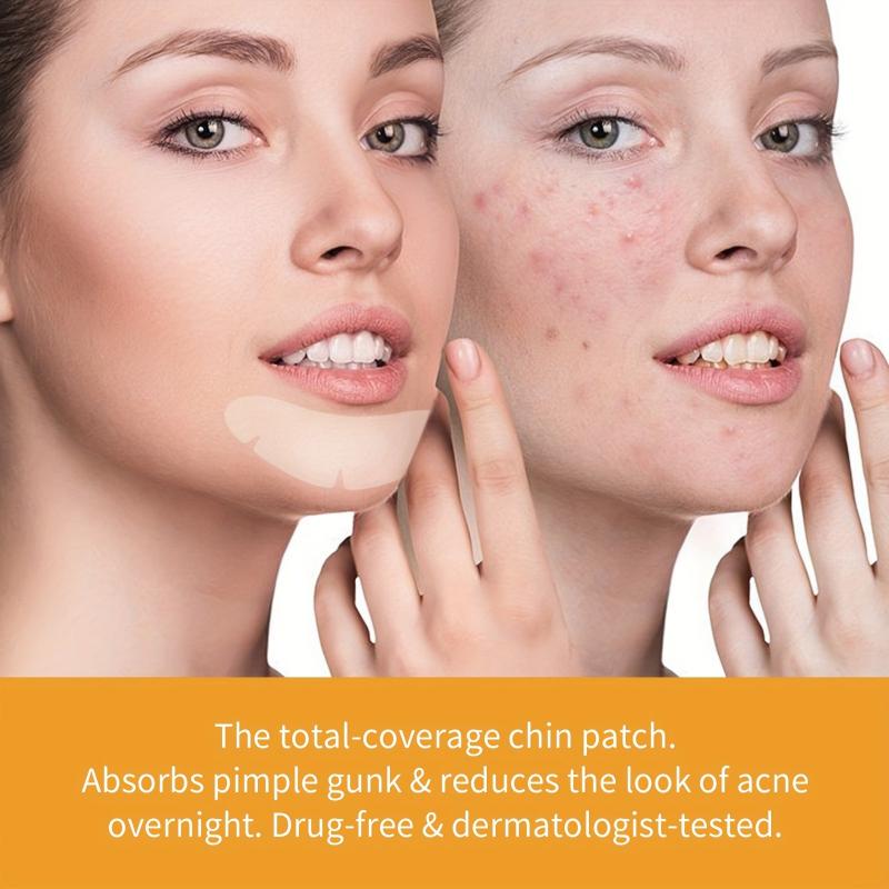 Hydrocolloid Acne Pimple Patch - Acne Cleansing Patch