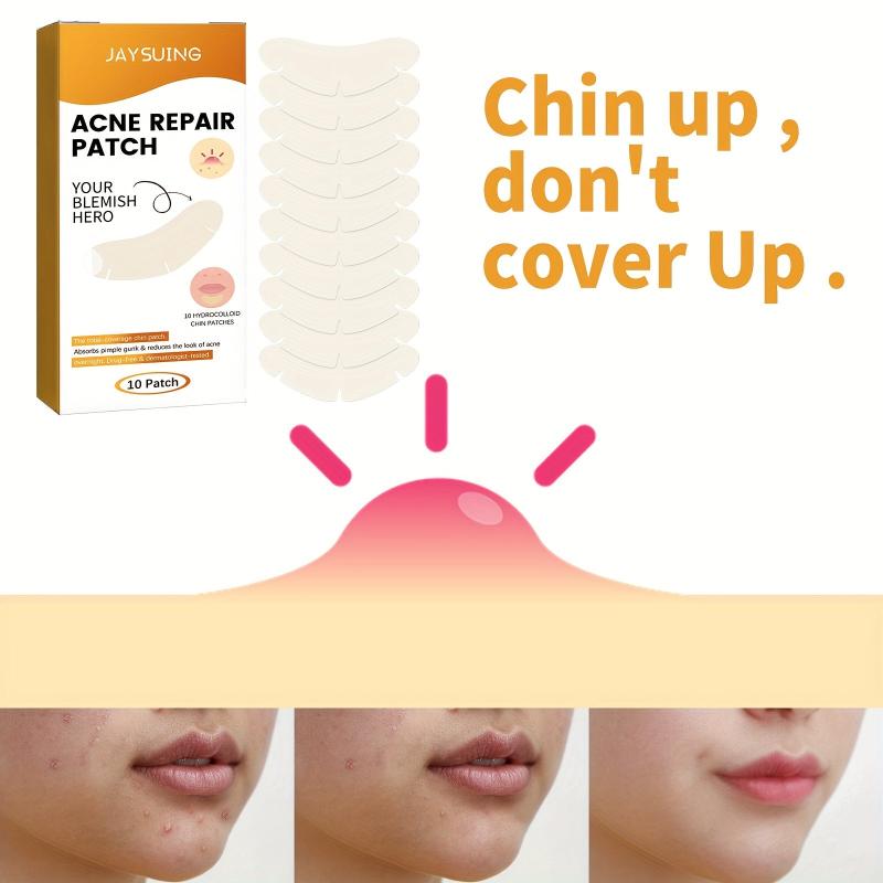 Hydrocolloid Acne Pimple Patch - Acne Cleansing Patch