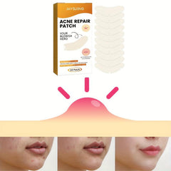 Hydrocolloid Acne Pimple Patches for Face Skin