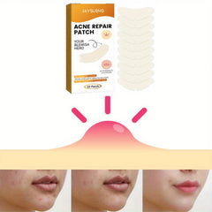 Hydrocolloid Acne Pimple Patches for Face Skin