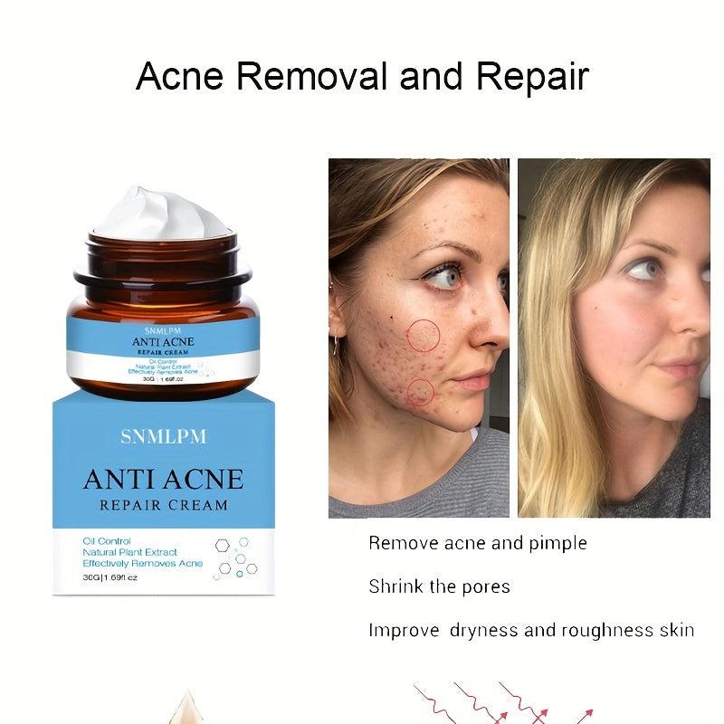 Natural Face Cream for Acne Marks and Pits - Skin Repair Formula