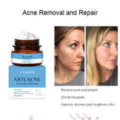 Natural Face Cream for Acne Marks and Pits - Skin Repair Formula