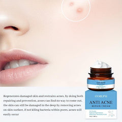 Natural Face Cream for Acne Marks and Pits - Skin Repair Formula