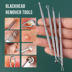 4PCS Stainless Steel Blackhead Remover Tool Acne Needle Set