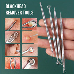 4PCS Stainless Steel Blackhead Remover Tool Acne Needle Set
