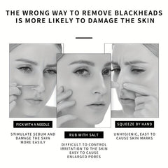 Bamboo Charcoal Nasal Mask for Acne Removal Blackheads Pores Cleansing