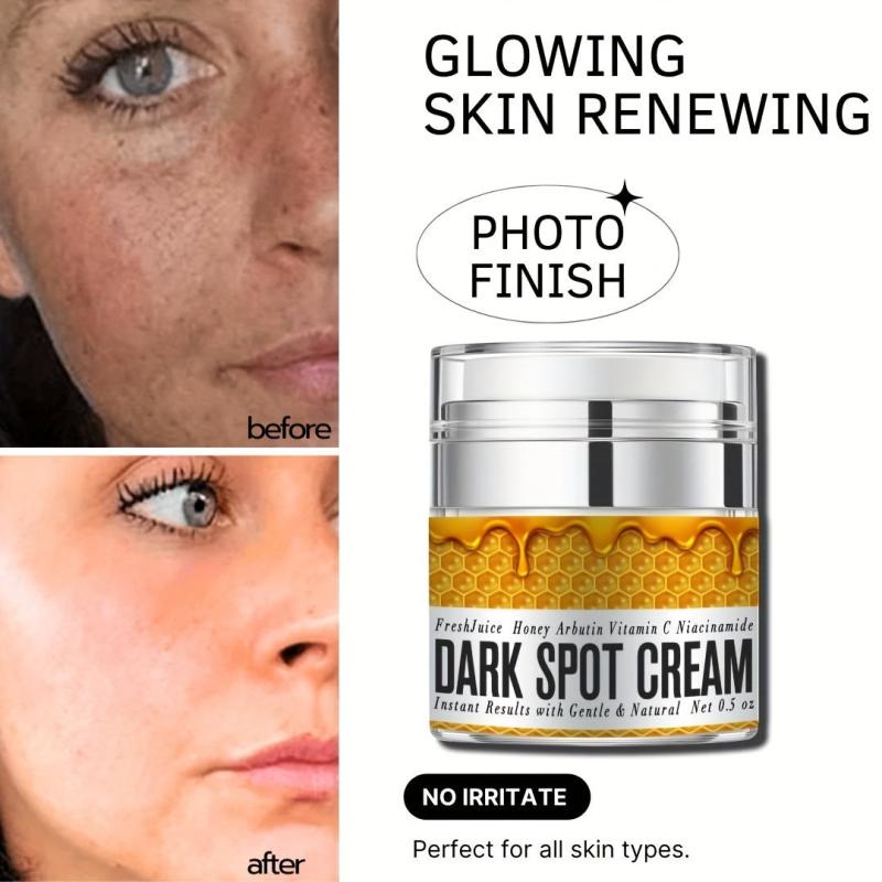 Dark Spot Remover Cream - Natural Skincare for Face & Body