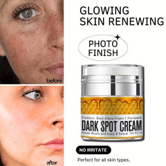 Dark Spot Remover Cream - Natural Skincare for Face & Body