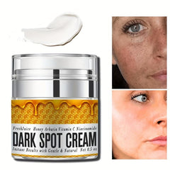 Dark Spot Remover Cream - Natural Skincare for Face & Body