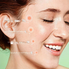 Hydrocolloid Acne Pimple Patches - Cover Zits and Blemishes