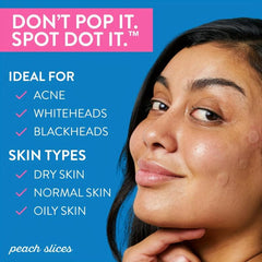 144 Ct Acne Pimple Patch Hydrocolloid Zit Patch Tea Tree Blemish Cover