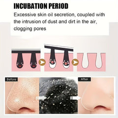 Blackhead Nose Strips & Spot Stickers Set - Clear Skin