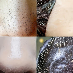 Blackhead Nose Strips & Spot Stickers Set - Clear Skin