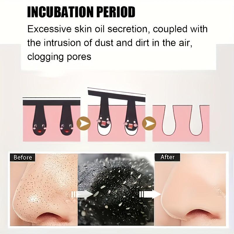 Blackhead Nose Strips & Spot Stickers Set - Clear Skin