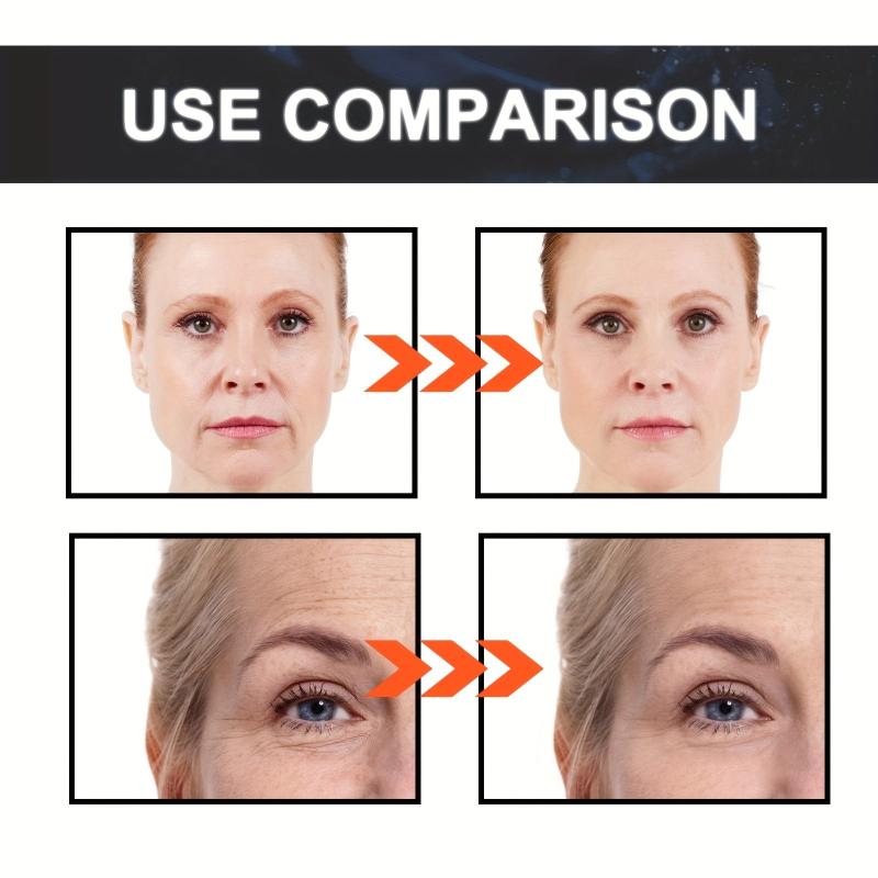 Retinol Serum for Face Diminishes Signs of Aging