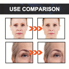 Retinol Serum for Face Diminishes Signs of Aging