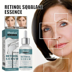 Retinol Serum for Face Diminishes Signs of Aging