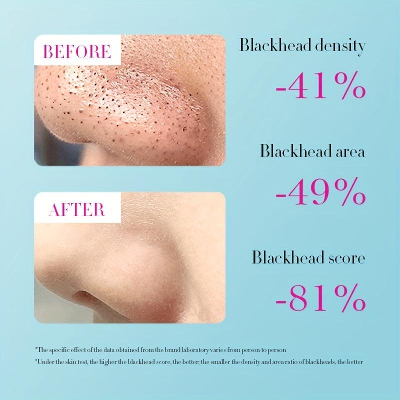Blackhead Cleaning Nose Patch Set