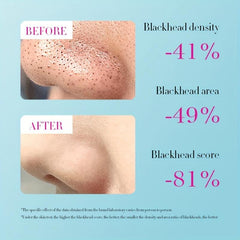Blackhead Cleaning Nose Patch Set