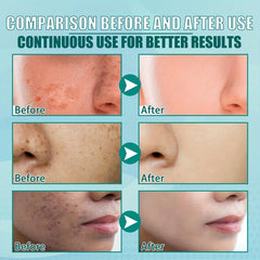 Moisturizing Spot Cream 40g with Squalane & Nicotinamide