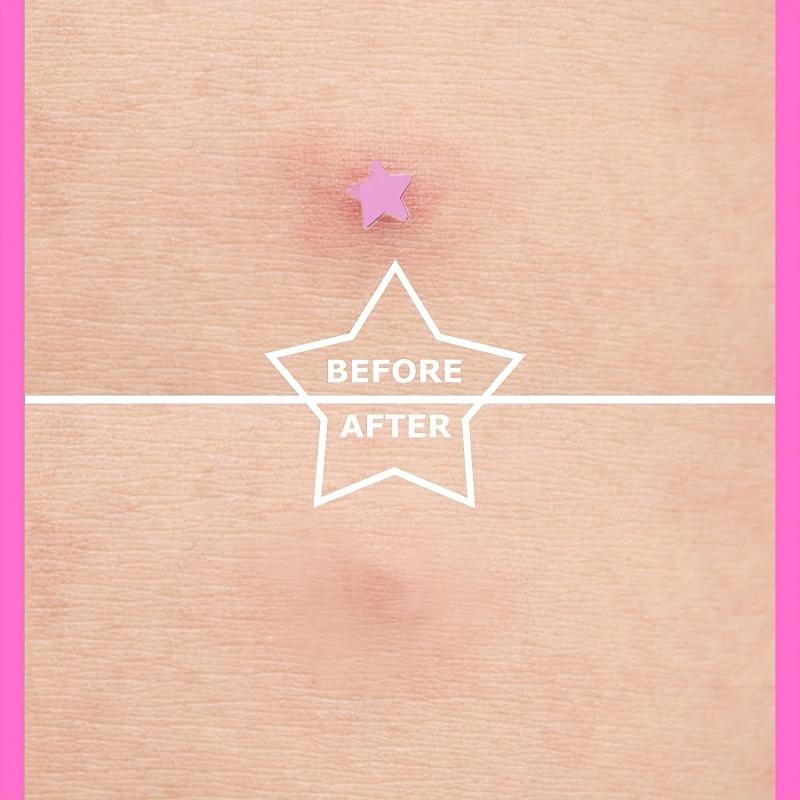 Hot Pink Acne Patch Pimple Patch Heart & Star Absorbing Cover