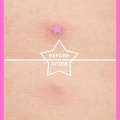 Hot Pink Acne Patch Pimple Patch Heart & Star Absorbing Cover