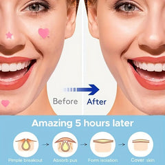 Hot Pink Acne Patch Pimple Patch Heart & Star Absorbing Cover