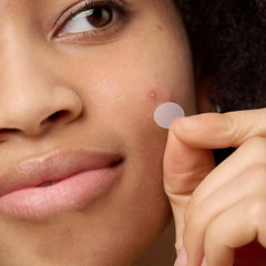 Acne Pimple Patch 540 Pcs Spot Stickers for Face Skin Vegan Not Tested