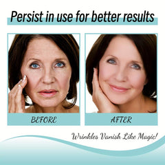 Wrinkle Patch Smooths Forehead Skin Tightens Relax Skin