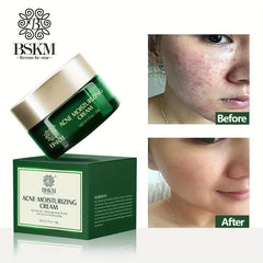 Tea Tree Acne Repairing Moisturizer Face Cream