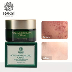 Tea Tree Acne Repairing Moisturizer Face Cream